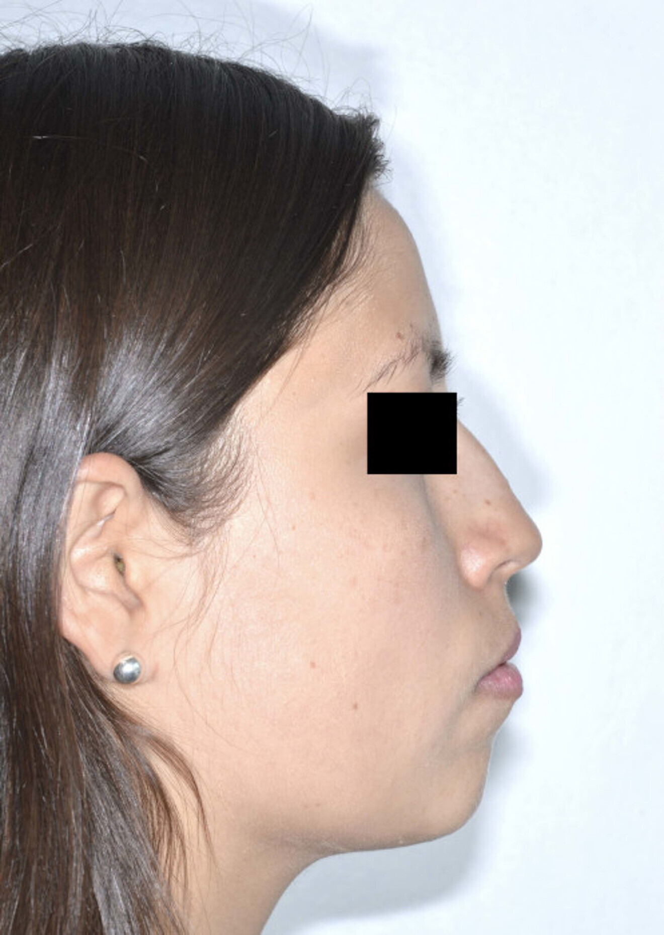 Fig. 11a: Profile comparison before ...