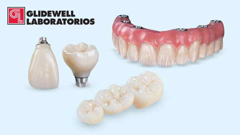 Alta estética a prueba de martillo