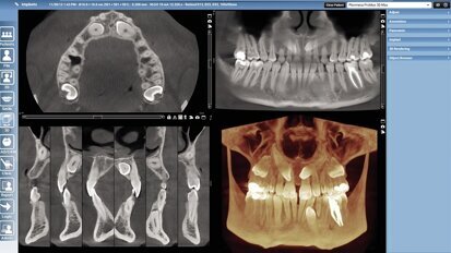 Planmeca software allows multiple applications for dental facilities Planmeca software allows multiple applications for dental facilities