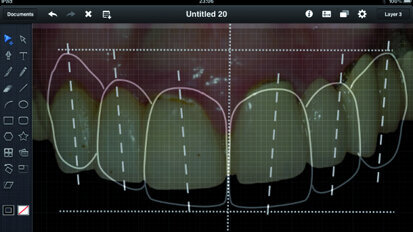 ADF 2015 : Utiliser l’iPad au cabinet dentaire