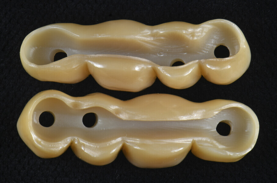 Fig. 14: Zirconia shells designed on the core file.