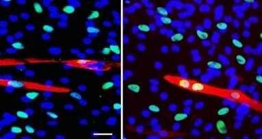 Les dentistes récoltent des cellules souches pour la médecine régénérative de l'avenir