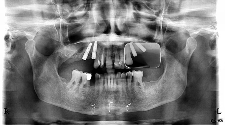 Fig. 50_Controllo radiografico.