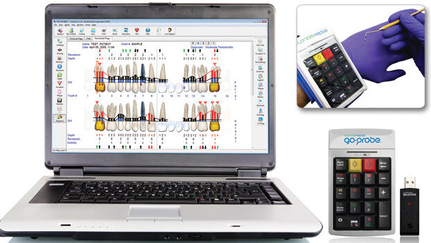 Florida Probe releases new periodontal charting system