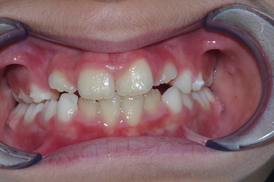 Fig. 10b: Frontal view.