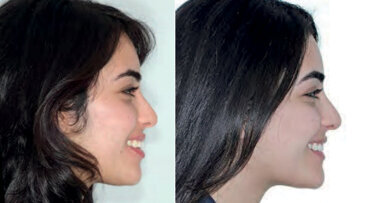 Can we treat patients in fewer visits?