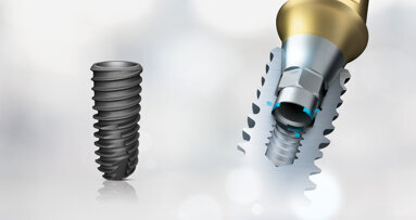 KS system: Key solution for strong dental implants