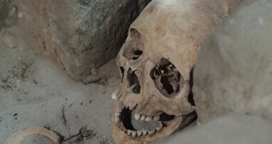 Zivilisationskrankheit Karies gab es bereits vor 12,5 Mio. Jahren