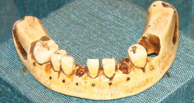 Museum dispels myth about George Washington’s teeth