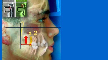 Técnicas y tecnologías terapéuticas en odontología
