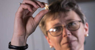 Pierwsze stałe zęby trzonowe są bazą danych zdrowia sprzed czasów porodowych