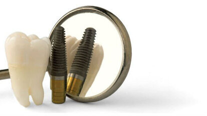 Dice Cochrane: “Non è provato che alcuni impianti abbiano maggior durata (e quindi successo)”