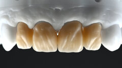 Une formule simple pour de merveilleux sourires