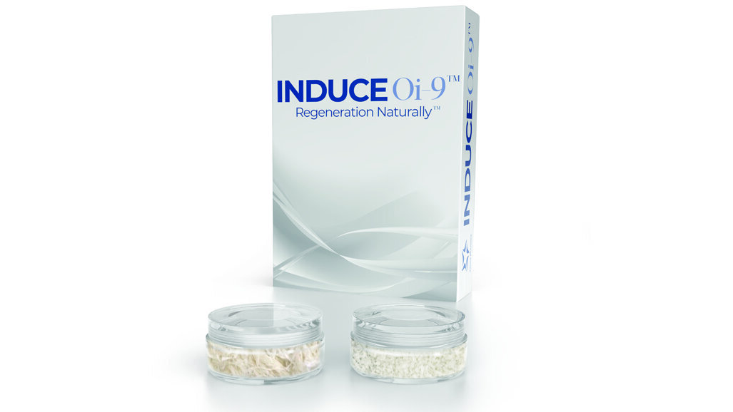 Bioavailable growth factors for bone regeneration