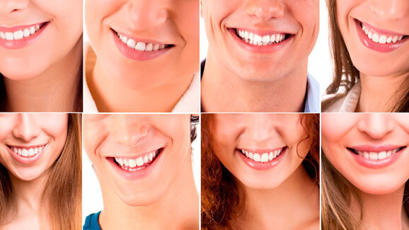 Meglio un sorriso perfetto o “globalizzzato” oppure con qualche difetto ma personale?