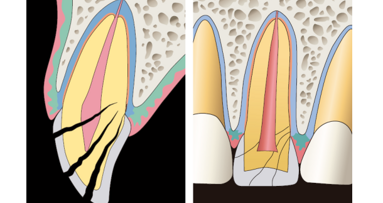 ‘Tandletsel hoort thuis bij de algemeen practicus’