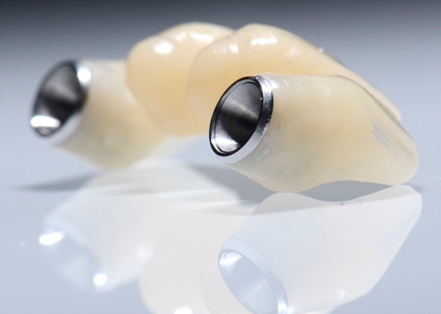 ig. 61 - Provvisorio e precisione. 