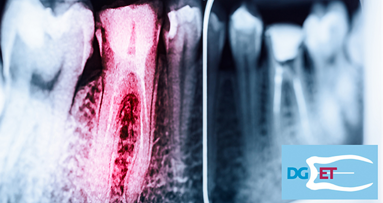 Noch freie Plätze beim Curriculum Endodontie der DGET