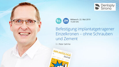 Webinar Teaser - Dentsply Sirona - Befestigung implantatgetragener Einzelkronen