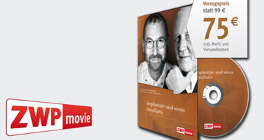 Neu: DVD „Implantate und Sinus maxillaris“