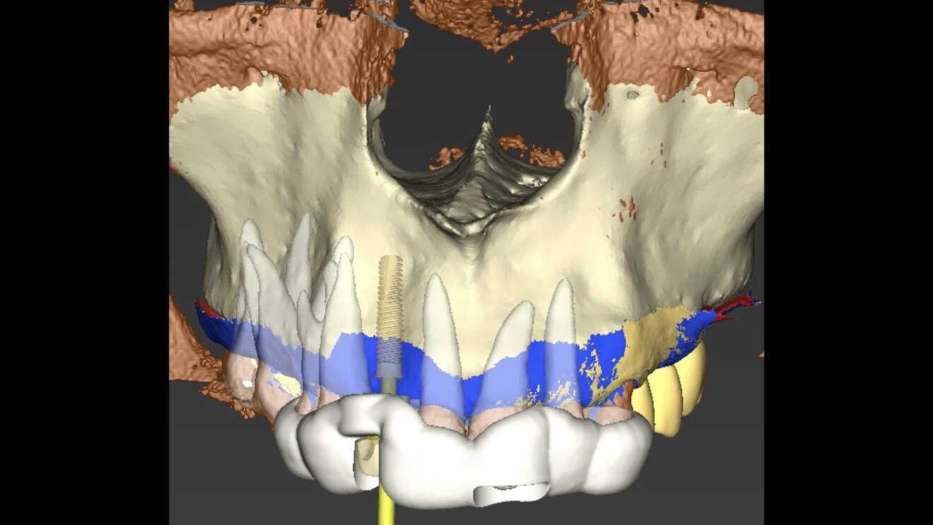 Fig. 3
