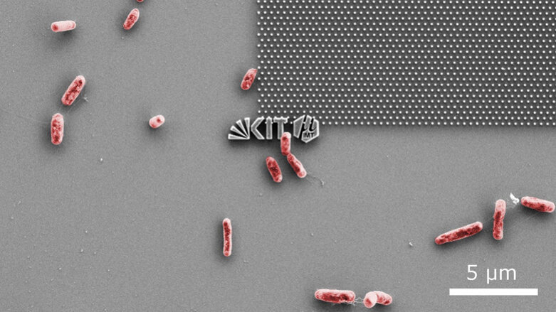 Zahnimplantate: Mit Nanotechnik gegen Bakterien