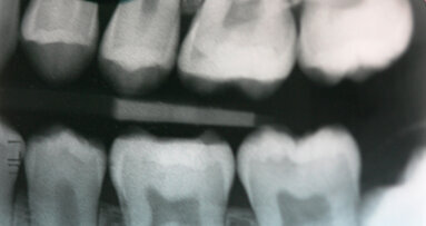 Riabilitazione conservativa con tecnica diretta e indiretta: case report