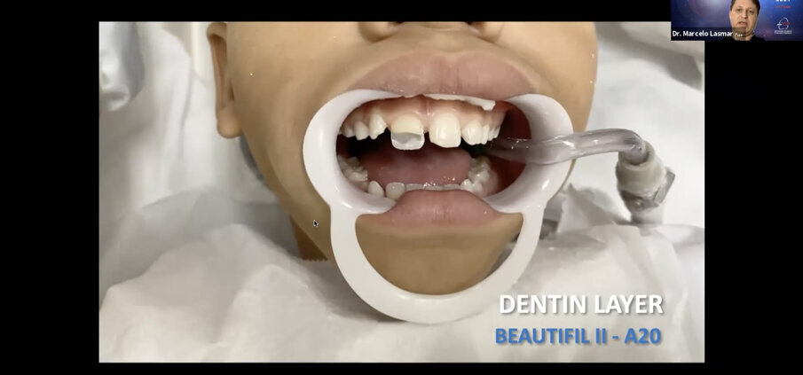 Lecture of Dr Marcelo Lasmar, Brazil