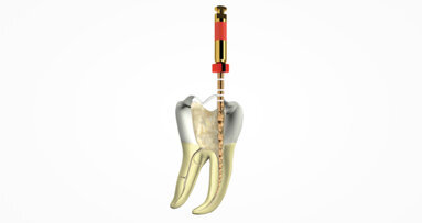 WaveOne Gold turns ten: Dentsply Sirona celebrates a decade of endodontic innovation