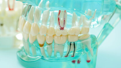 Endodontic training: Study calls for standardisation, modernisation