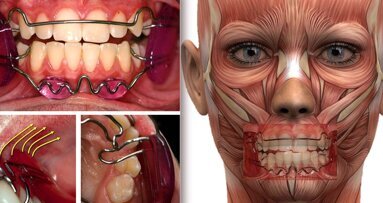 Los beneficios en la salud general de la Ortodoncia Médica