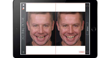 Kdo potřebuje Digital Smile Design (DSD)?