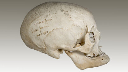 Etude en paléonthologie maxillofaciale de spécimens rares