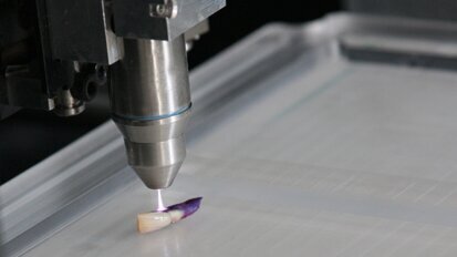 Plasma wirkt enzündungshemmend Plasma wirkt enzündungshemmend