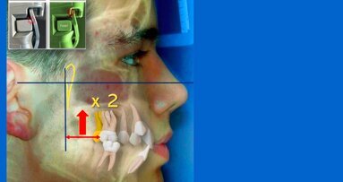 Técnicas y Tecnologías Terapéuticas en Odontología