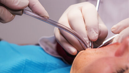 Periodontitis could increase stroke risk, new study says Periodontitis could increase stroke risk, new study says