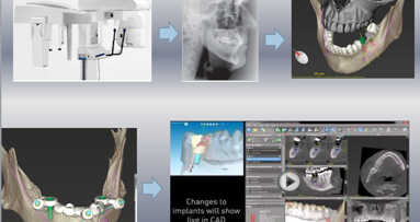 Κλινικά συστήματα Cad-Cam ...Μύθοι και Πραγματικότητα