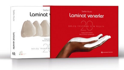 Laminat Venerler - Gülüş Tasarımı için 20 Reçete