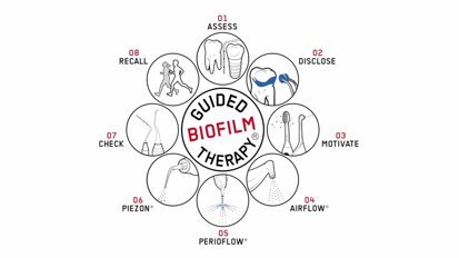 Patient undergoing chemotherapy gets a dental cleaning (Guided Biofilm Therapy)