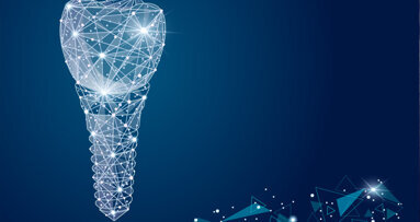 Individuelle Implantate basierend auf CAD/CAM-Verfahren