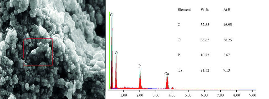 Fig 3c : Analyse EDS sous un grossissement de 5 000 fois (c) de la poudre de HAP II au contact d’une solution aqueuse. Les images montrent la forme cristallite et la tendance a la formation d’agrégats