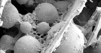 Der Klebstoff von Bakterien