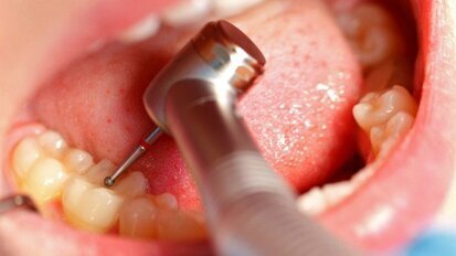 Falsa dentista sentenciada por fraude e danos comerciais