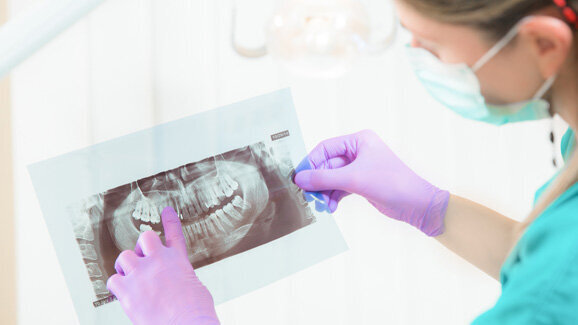 Studie: Skepsis gegenüber Krebsgefahr beim Röntgen