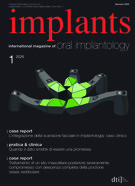 implants Italy No. 1, 2026