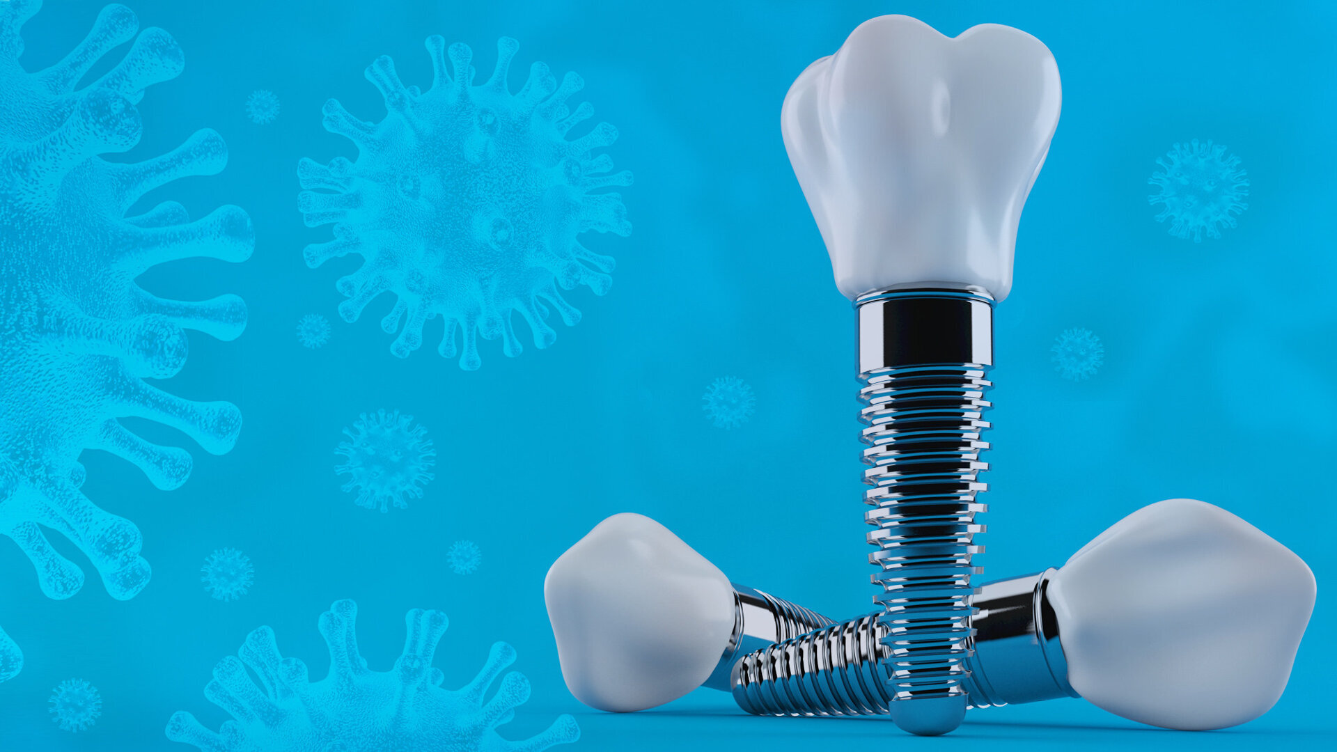 Interview on the impact of SARS-CoV-2 on dental implantology