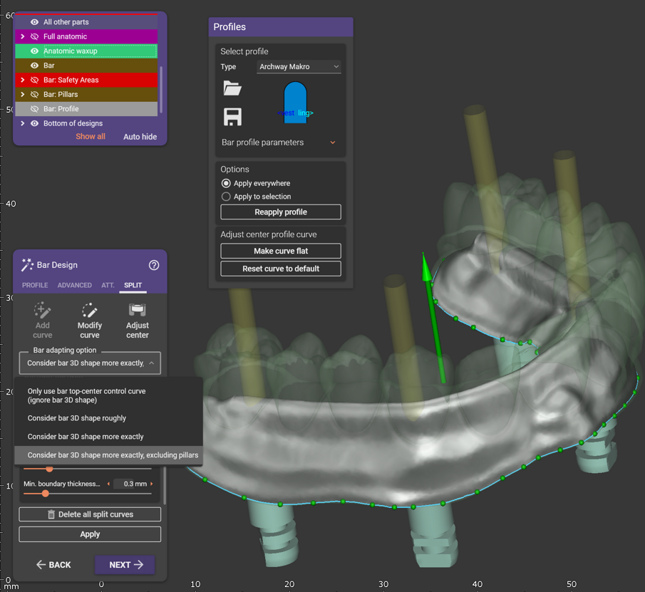Fig. 6: Preview how the software separates the bar from the suprastructure depending on the selected option. 