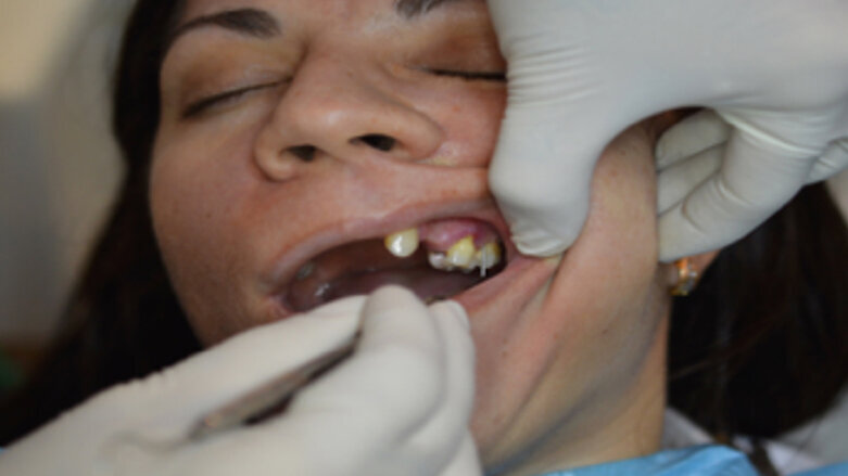 Indicaciones postquirúrgicas