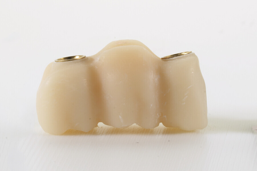 Fig. 10b: Bridge after support removal. 