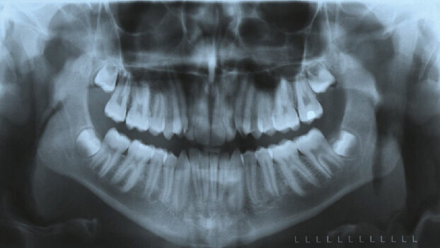 The age of digital imaging (Part 1)